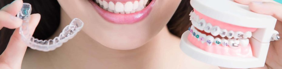 the difference between invisalign and braces