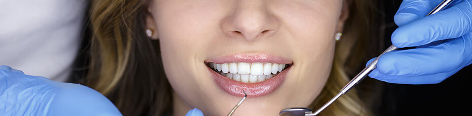 teeth whitening for sensitive teeth safe options that work